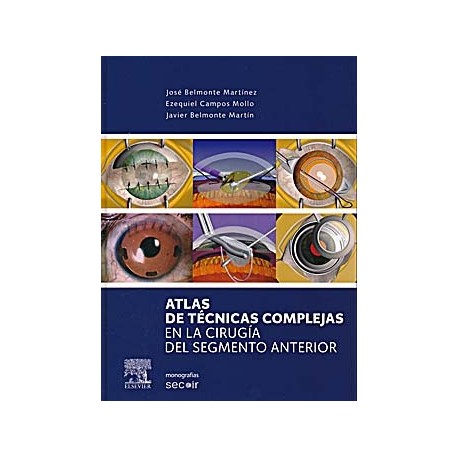 ATLAS DE TECNICAS COMPLEJAS EN LA CIRUGIA DEL SEGMENTO ANTERIOR (MONOGRAFIAS SECOIR)
