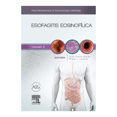 ESOFAGITIS EOSINOFILICA (CLINICAS IBEROAMERICANAS DE GASTROENTEROLOGIA Y HEPATOLOGIA VOL.5)