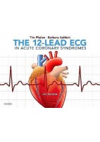 THE 12-LEAD ECG IN ACUTE CORONARY SYNDROMES
