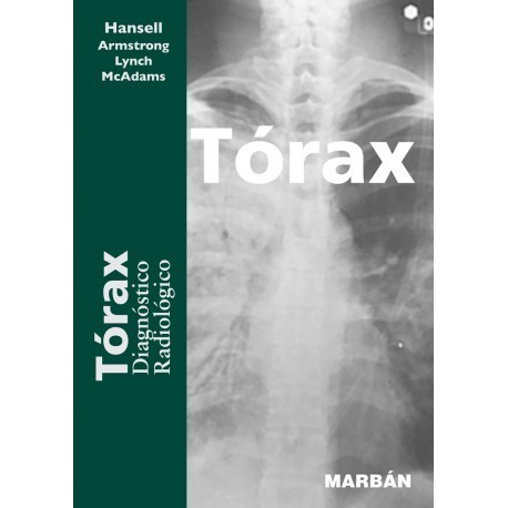 TORAX. DIAGNOSTICO RADIOLOGICO. FORMATO PREMIUM