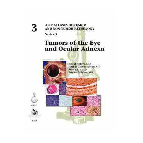 TUMORS OF THE EYE AND OCULAR ADNEXA (AFIP ATLASES OF TUMOR AND NON-TUMOR PATHOLOGY SERIES 5 - VOL. 3)