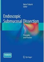 ENDOSCOPIC SUBMUCOSAL DISSECTION