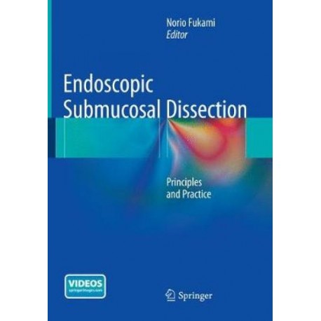 ENDOSCOPIC SUBMUCOSAL DISSECTION