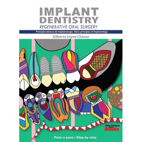 IMPLANT DENTISTRY. PRINCIPIOS BASICOS DE IMPLANTOLOGIA