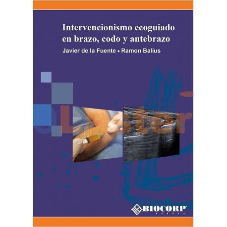 INTERVENCIONISMO ECOGUIADO EN BRAZO, CODO Y ANTEBRAZO