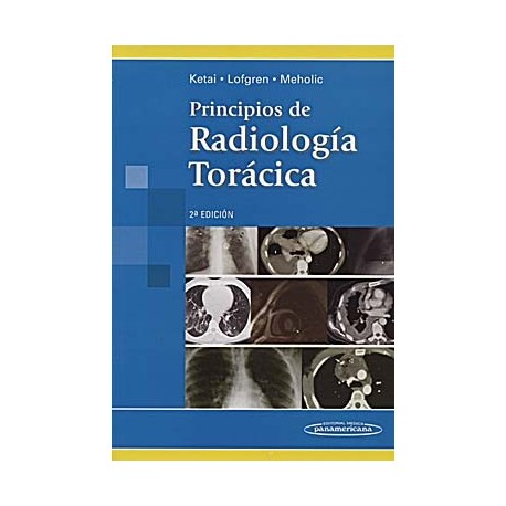 PRINCIPIOS DE RADIOLOGIA TORACICA