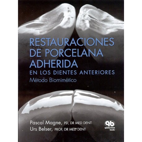 RESTAURACIONES DE PORCELANA ADHERIDA EN LOS DIENTES ANTERIORES: UN ENFOQUE BIOMIMETICO
