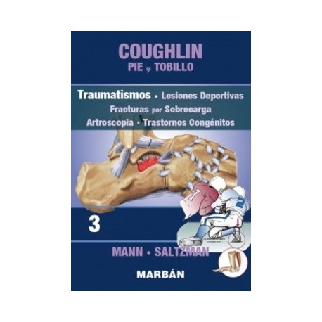 COUGHLIN PIE Y TOBILLO (TOMO 3) TRAUMATISMOS. LESIONES DEPORTIVAS. FRACTURAS POR SOBRECARGA. ARTROSCOPIA. TRASTORNOS CONGENITOS