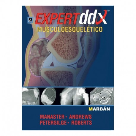 EXPERT DDX MUSCULOESQUELETICO