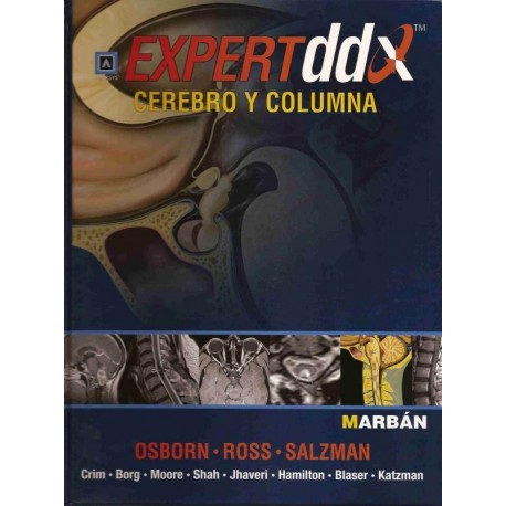 EXPERT DDX CEREBRO Y COLUMNA