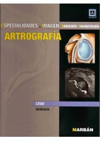 ESPECIALIDADES EN IMAGEN. ARTROGRAFIA