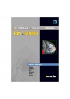 ESPECIALIDADES EN IMAGEN: RM DE MAMA