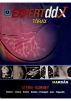 EXPERT DDX TORAX