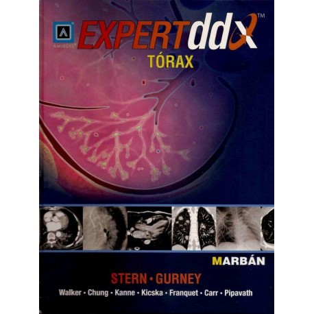 EXPERT DDX TORAX