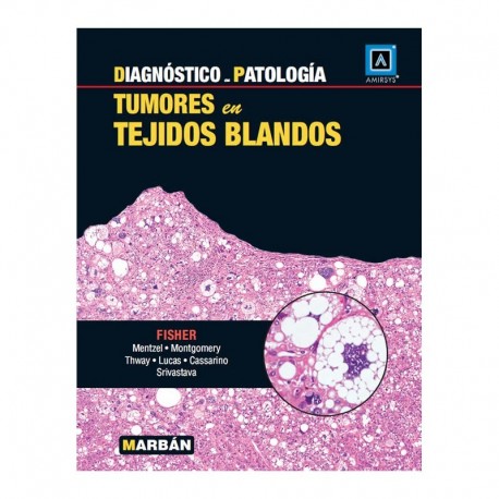 DIAGNOSTICO EN PATOLOGIA. TUMORES EN TEJIDOS BLANDOS