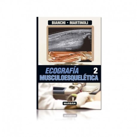 ECOGRAFIA MUSCULOESQUELETICA. TOMO 2. FLEXILIBRO (REIMPRESION 2021)