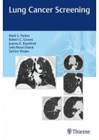 LUNG CANCER SCREENING