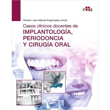CASOS CLINICOS DOCENTES DE IMPLANTOLOGIA, PERIODONCIA Y CIRUGIA ORAL