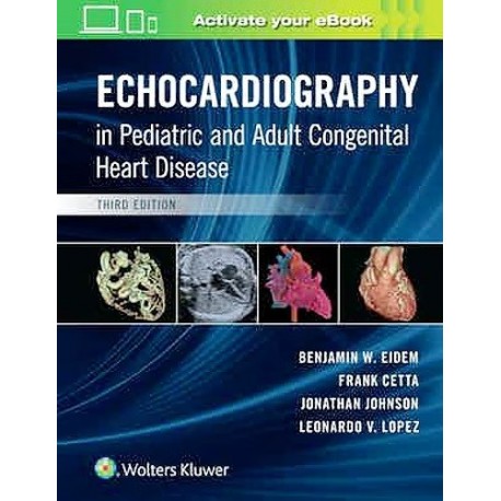 ECHOCARDIOGRAPHY IN PEDIATRIC AND ADULT CONGENITAL HEART DISEASE