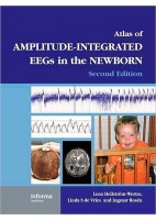 AN ATLAS OF AMPLITUDE-INTEGRATED EEGs IN THE NEWBORN
