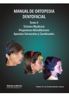 MANUAL DE ORTOPEDIA DENTOFACIAL. TOMO II. SISTEMA MYOBRACE. PROPULSORES MANDIBULARES. APARATOS EXTRAORALES Y COMBINADOS