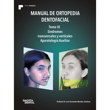 MANUAL DE ORTOPEDIA DENTOFACIAL. TOMO III. SINDROMES TRASVERSALES Y VERTICALES. APARATOLOGIA AUXILIAR