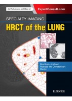 SPECIALTY IMAGING. HRCT OF THE LUNG (ONLINE AND PRINT)