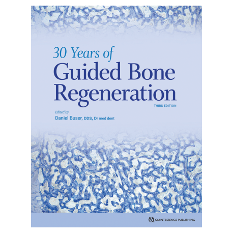 30 YEARS OF GUIDED BONE REGENERATION
