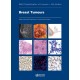 WHO CLASSIFICATION OF TUMOURS: BREAST TUMOURS