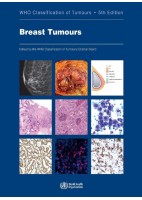 WHO CLASSIFICATION OF TUMOURS: BREAST TUMOURS