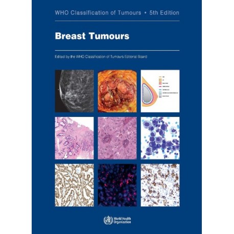WHO CLASSIFICATION OF TUMOURS: BREAST TUMOURS