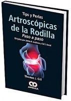 TIPS Y PERLAS ARTROSCOPICAS DE LA RODILLA. PASO A PASO