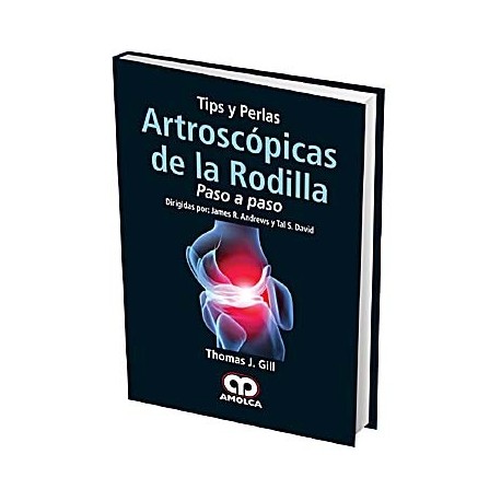TIPS Y PERLAS ARTROSCOPICAS DE LA RODILLA. PASO A PASO