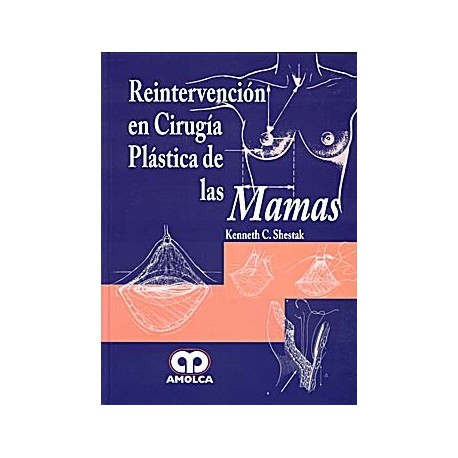 REINTERVENCION EN CIRUGIA PLASTICA DE LAS MAMAS