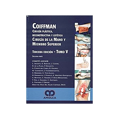 CIRUGIA PLASTICA, RECONSTRUCTIVA Y ESTETICA, T-V: MANO Y MIEMBRO SUPERIOR (2Âª PARTE)