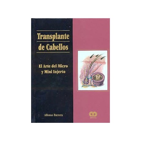 TRANSPLANTE DE CABELLOS. EL ARTE DEL MICRO Y MINI INJERTO