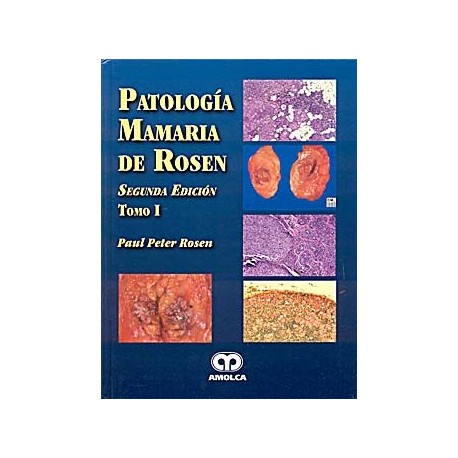 PATOLOGIA MAMARIA DE ROSEN (2 VOL.)
