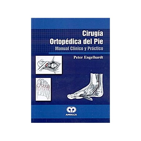 CIRUGIA ORTOPEDICA DEL PIE