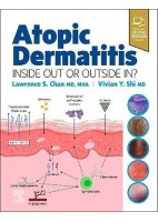 ATOPIC DERMATITIS. INSIDE OUT OR OUTSIDE IN