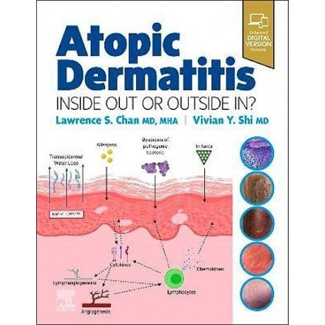 ATOPIC DERMATITIS. INSIDE OUT OR OUTSIDE IN