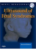 ULTRASOUND OF FETAL SYNDROMES + DVD