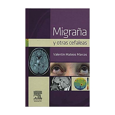 MIGRAÃ A Y OTRAS CEFALEAS