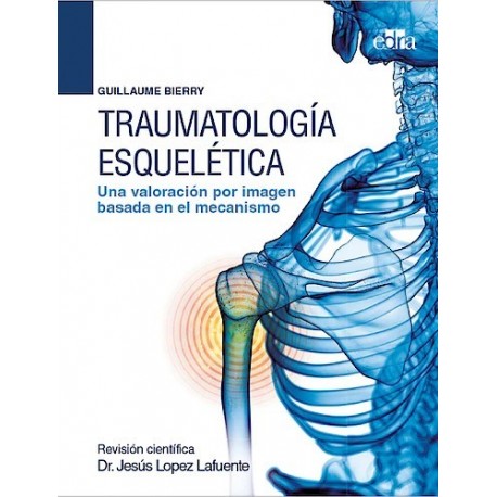 TRAUMATOLOGIA ESQUELETICA. UNA VALORACION POR IMAGEN BASADA EN EL MECANISMO
