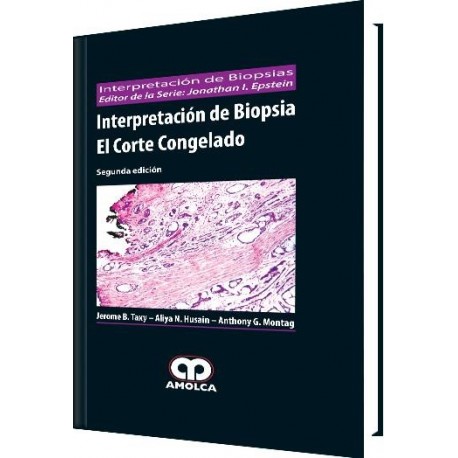 INTERPRETACION DE BIOPSIA. EL CORTE CONGELADO
