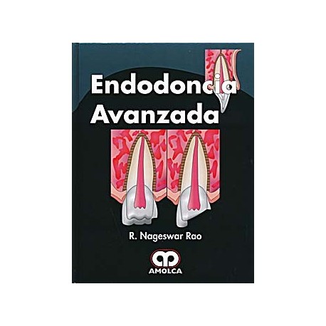 ENDODONCIA AVANZADA