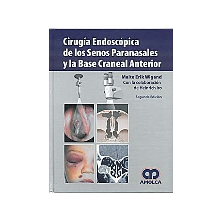 CIRUGIA ENDOSCOPICA DE LOS SENOS PARANASALES Y LA BASE CRANEAL ANTERIOR