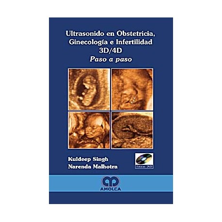 ULTRASONIDO EN OBSTETRICIA, GINECOLOGIA E INFERTILIDAD 3D/4D PASO A PASO + CD