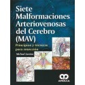 SIETE MALFORMACIONES ARTERIOVENOSAS DEL CEREBRO (MAV). PRINCIPIOS Y TECNICAS PARA RESECCION.
