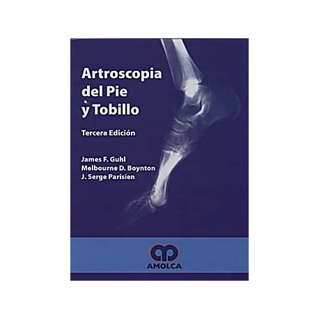 ARTROSCOPIA DEL PIE Y TOBILLO