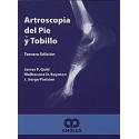 ARTROSCOPIA DEL PIE Y TOBILLO